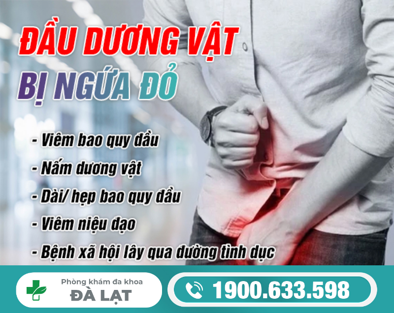 Hình ảnh minh họa